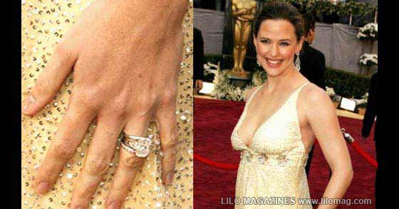 Anéis Mais Caros do Mundo Top 10: Anéis de Casamento Mais Caros do Mundo